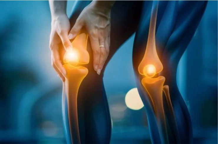 ACL Tears 2